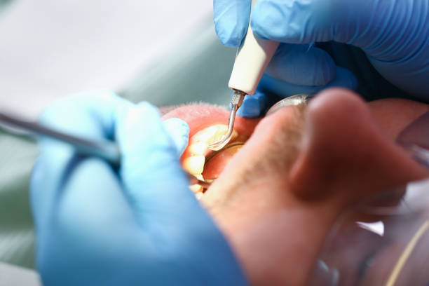 Best After-Hours Emergency Dentist in West Van Lear, KY