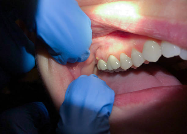 Best Emergency Treatment for Toothache in West Van Lear, KY